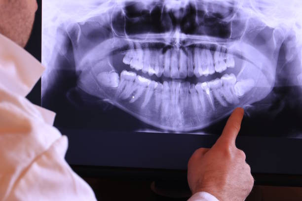 Best Emergency Dental Services for Seniors in Orangevale, CA