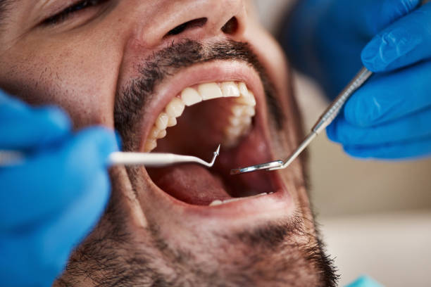 Best Weekend Emergency Dentist in Orangevale, CA